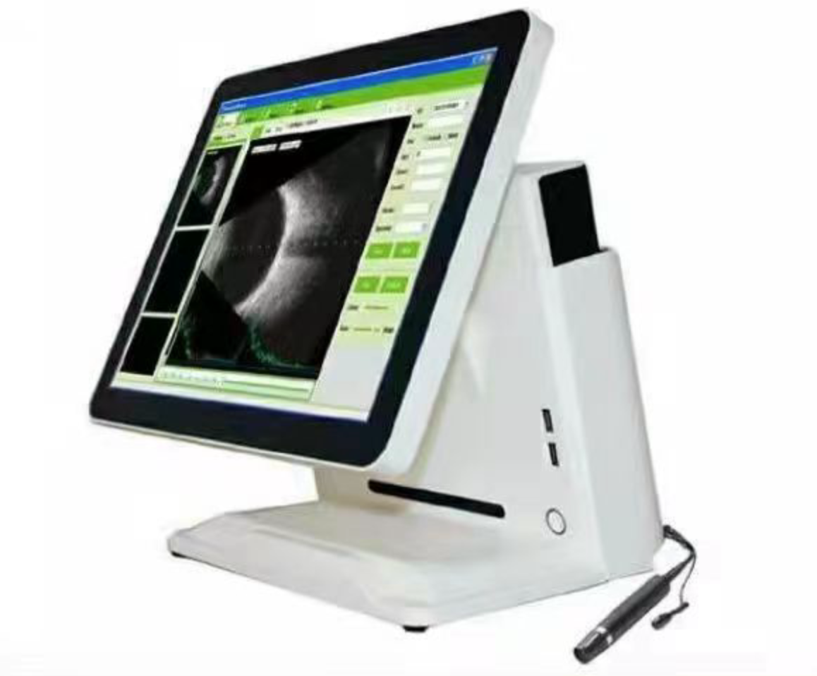 SAB-500 Ophthalmic A/B Scan - High-Resolution Digital Ultrasound for Eye Diagnosis