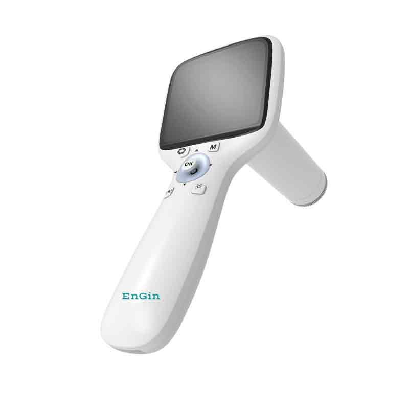 Digital Fundus Camera Non-Mydriatic Retinal Imaging System High Resolution Eye Examination Equipment